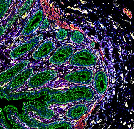 In this HuBMAP image, different colours represent different cell types inside the intestine.