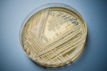 Candida auris in a petri dish