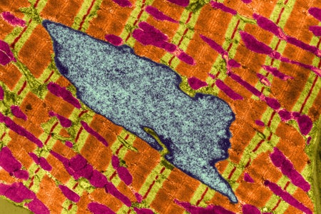 Human heart muscle cell with mitochondria