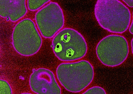 Plasmodium falciparum microscopic image.